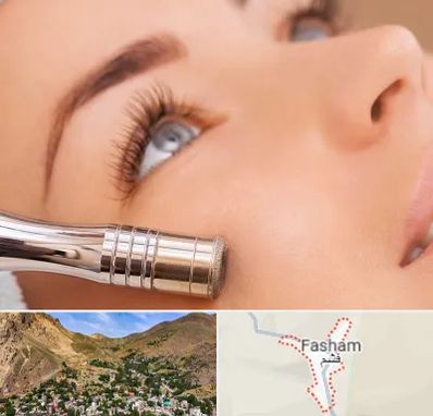 میکرودرم در فشم