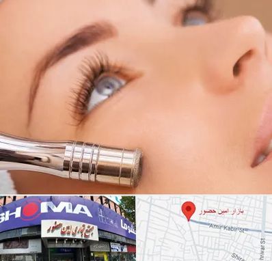 میکرودرم در امین حضور