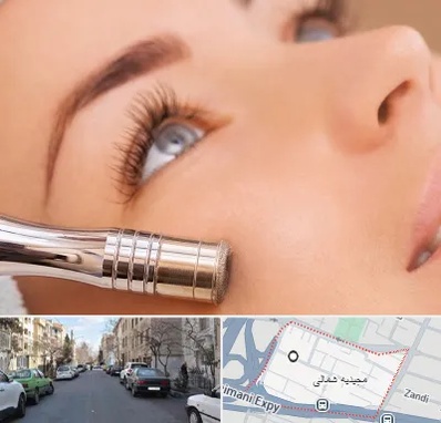 میکرودرم در مجیدیه شمالی