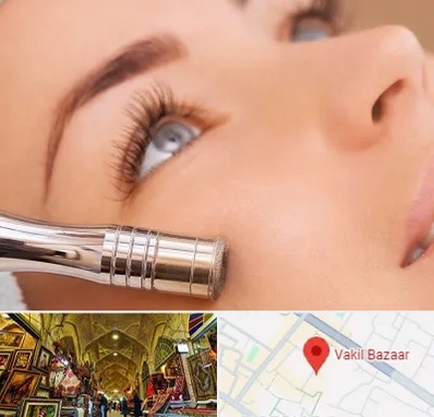 میکرودرم در بازار وکیل شیراز