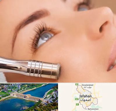 میکرودرم در اصفهان