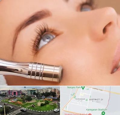 میکرودرم در تهرانسر 
