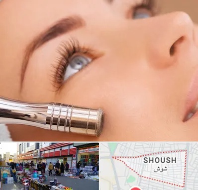 میکرودرم در شوش