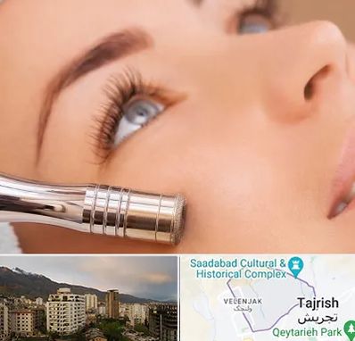 میکرودرم در زعفرانیه 