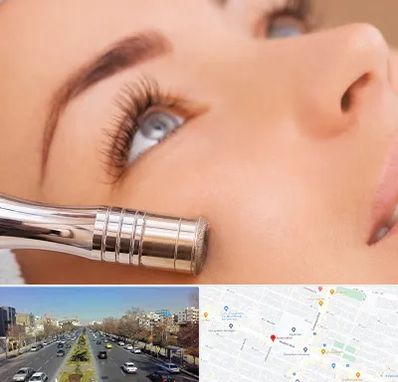میکرودرم در بلوار معلم مشهد