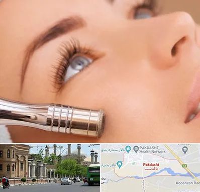 میکرودرم در پاکدشت