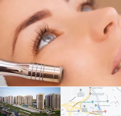 میکرودرم در المپیک 