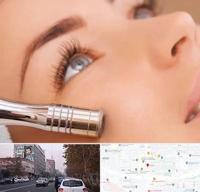 میکرودرم در کارگر شمالی 