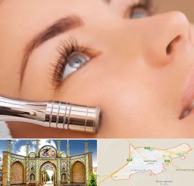 میکرودرم در سمنان