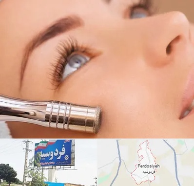 میکرودرم در فردوسیه شهریار