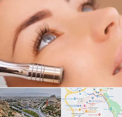 میکرودرم در معالی آباد شیراز