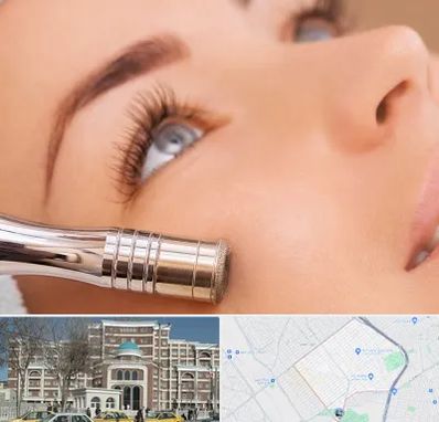 میکرودرم در طلاب مشهد