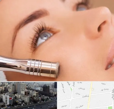 میکرودرم در زرتشت
