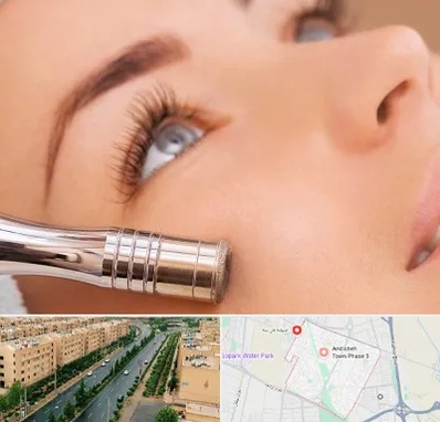 میکرودرم در فاز سه اندیشه