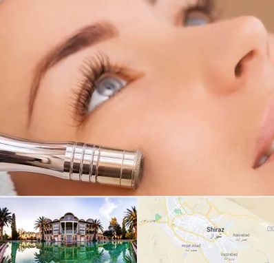 میکرودرم در شیراز