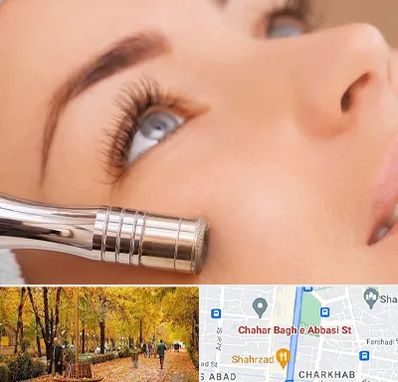 میکرودرم در چهارباغ اصفهان