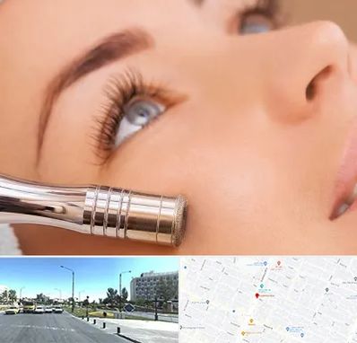 میکرودرم در بلوار کلاهدوز مشهد