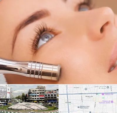 میکرودرم در مرکز تهران