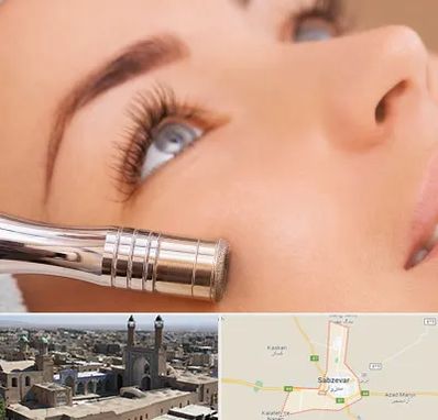 میکرودرم در سبزوار