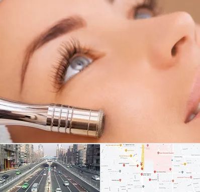 میکرودرم در توحید 