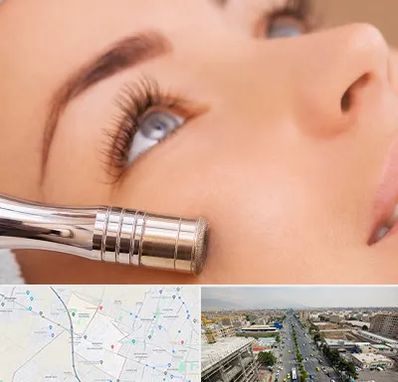 میکرودرم در حصارک کرج