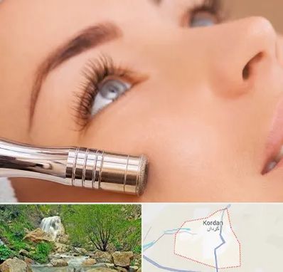 میکرودرم در کردان