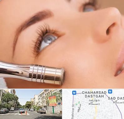 میکرودرم در چهارصد دستگاه 