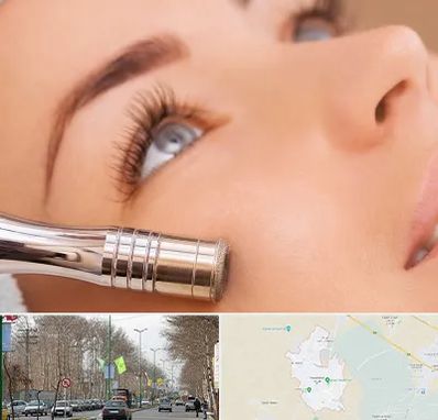 میکرودرم در نظرآباد کرج