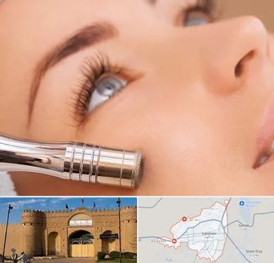 میکرودرم در ایرانشهر