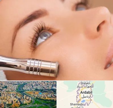 میکرودرم در اردبیل