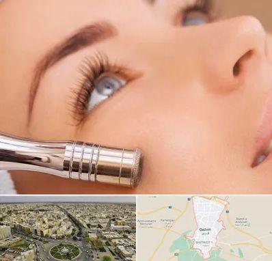 میکرودرم در قزوین