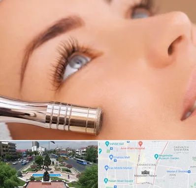 میکرودرم در بهارستان 