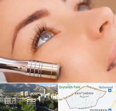 میکرودرم در اختیاریه 