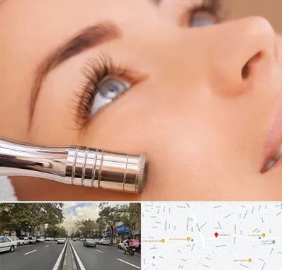 میکرودرم در دولت