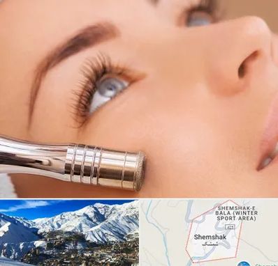 میکرودرم در شمشک