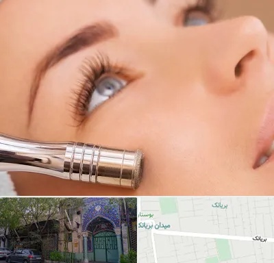 میکرودرم در بریانک