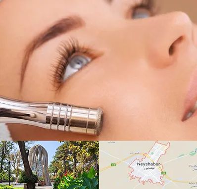 میکرودرم در نیشابور