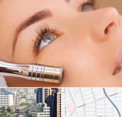 میکرودرم در خیابان بهشتی