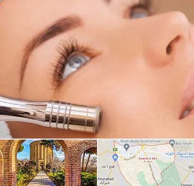 میکرودرم در شهر ری