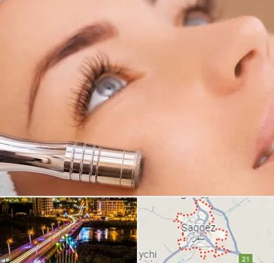 میکرودرم در سقز