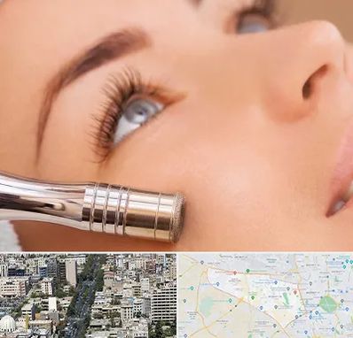 میکرودرم در منطقه 18 تهران 