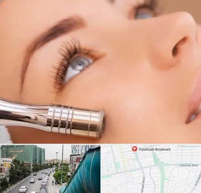 میکرودرم در بلوار فرحزادی