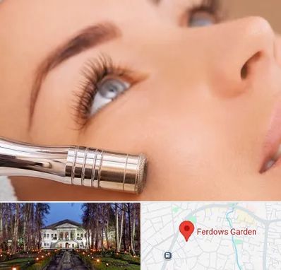 میکرودرم در باغ فردوس