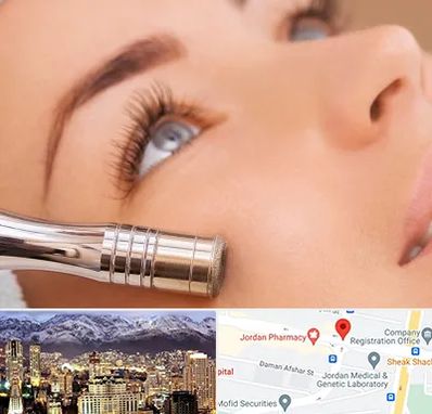 میکرودرم در جردن 