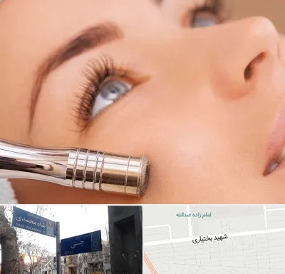 میکرودرم در سی متری جی