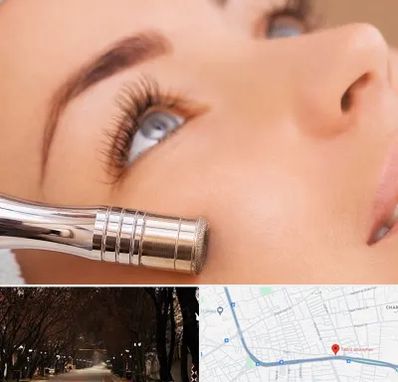 میکرودرم در ابوریحان تبریز