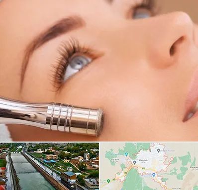 میکرودرم در مراغه