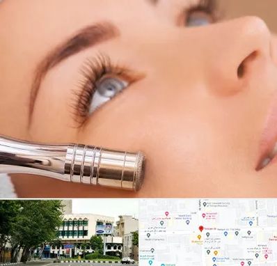 میکرودرم در طالقانی 