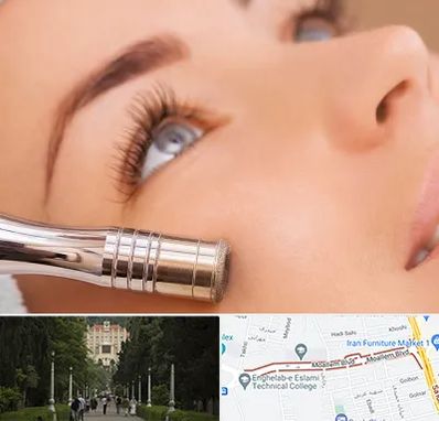 میکرودرم در بلوار معلم رشت 