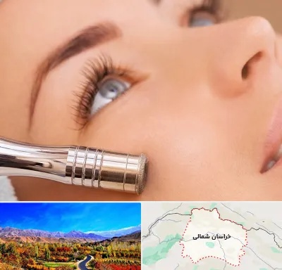 میکرودرم در خراسان شمالی